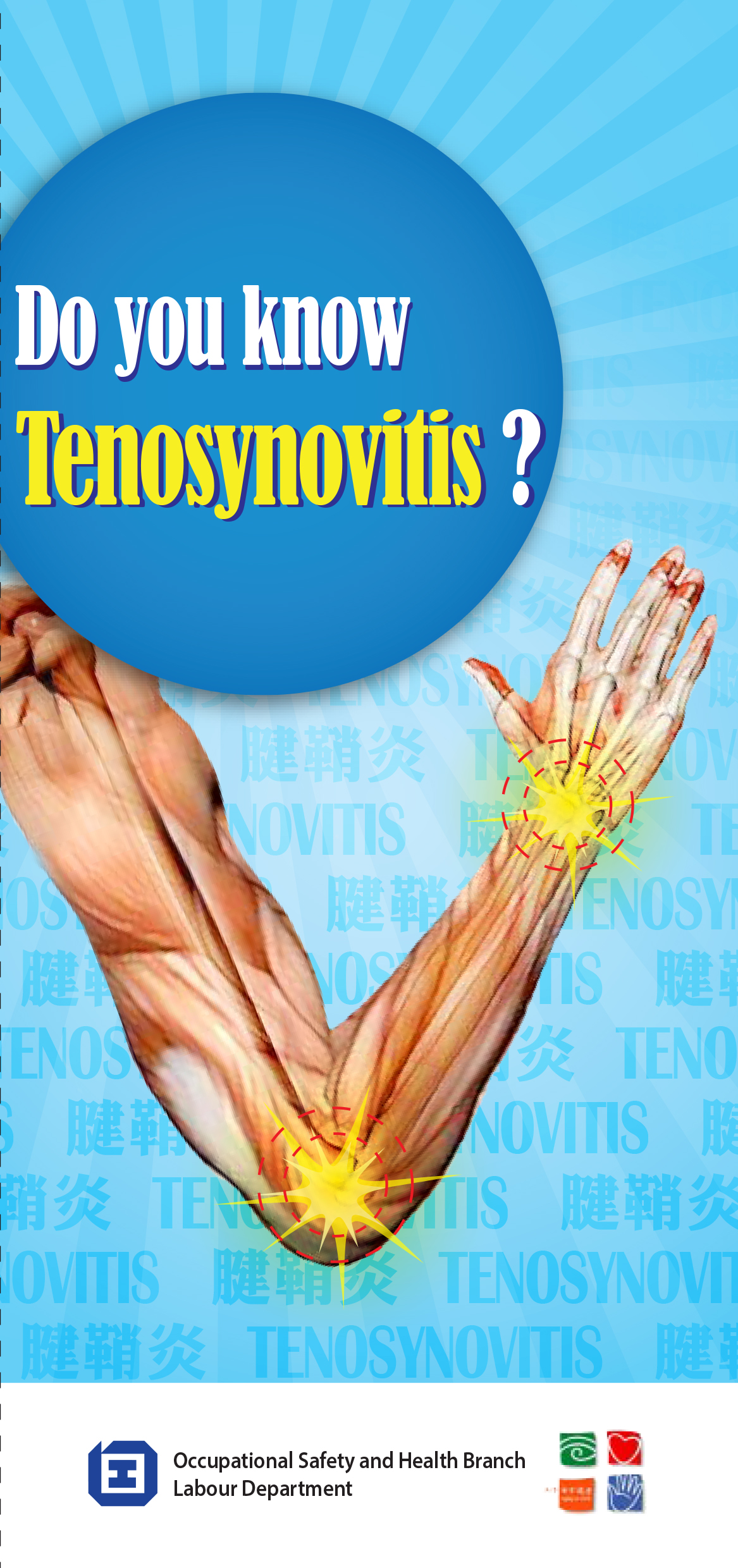 Do you know tenosynovitis? (published by the Labour Department)